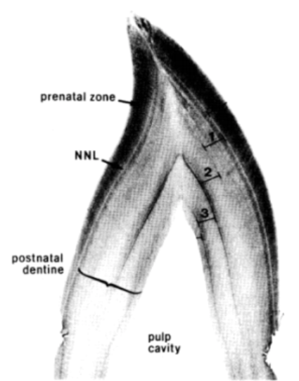  A good section of a bottlenose dolphin tooth